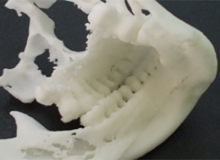 DICOMデータからSTLデータ変換し、3Dプリンタで造形する