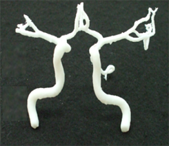 DICOMデータから動脈瘤と脳血管を造形した例。　画像ご提供先: 志太記念脳神経外科様