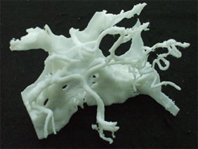 DICOMデータから動脈瘤と脳血管を造形した例。　画像ご提供先: 志太記念脳神経外科様