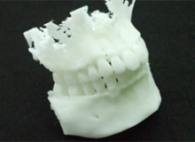 DICOMデータからSTLデータ変換し、3Dプリンタで造形する