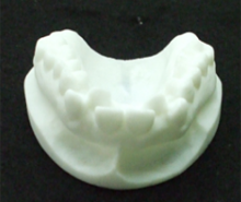 石膏モデルを3Dスキャンし、3Dプリンタで造形する