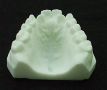 石膏モデルを3Dスキャンし、3Dプリンタで造形する