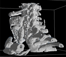 DICOM画像から喉頭モデルを作成する