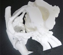 DICOM画像から喉頭モデルを作成する