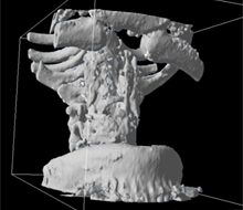 DICOM画像から喉頭モデルを作成する