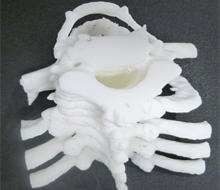 DICOM画像から喉頭モデルを作成する