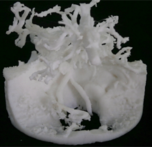 3Dプリンタ UP! Plusの作成例：骨と脳血管