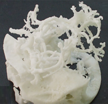 3Dプリンタ UP! Plusの作成例：骨と脳血管