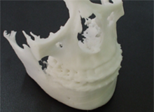 DICOMデータからSTLデータ変換し、3Dプリンタで造形する