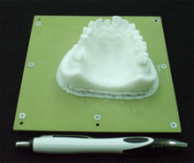石膏モデルを3Dスキャンし、3Dプリンタで造形する