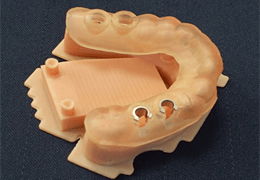 サージカルステントと歯科模型